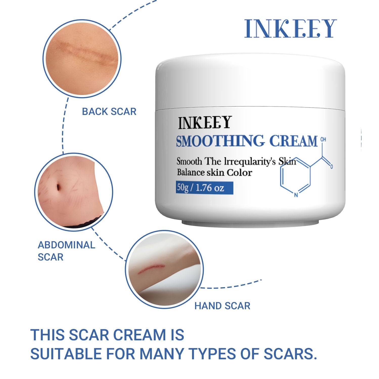 Skin Recovery Cream 50g Fade Scar